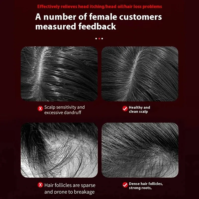 Electric Vibration Massage Com - Hair Care For Hair Loss 리뷰 및 가격