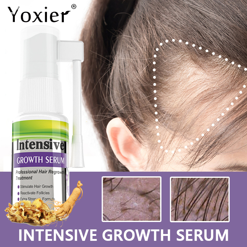 Intensive Growth Serum Prevent - Hair Care For Hair Loss 리뷰 및 가격