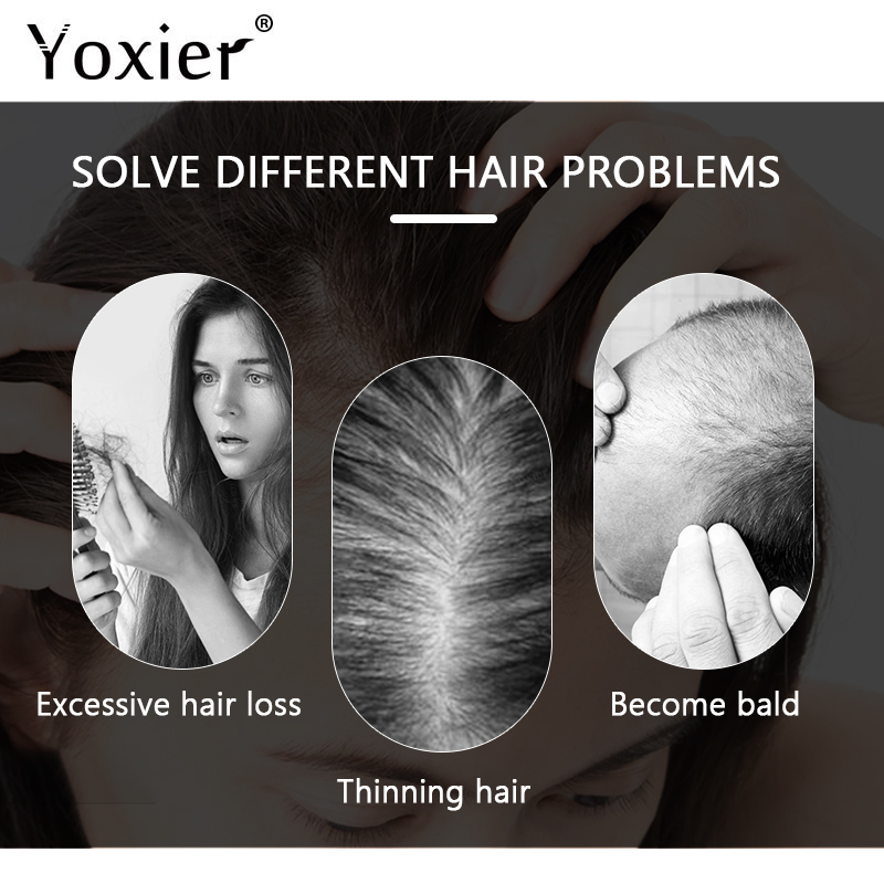 Intensive Growth Serum Prevent - Hair Care For Hair Loss 리뷰 및 가격