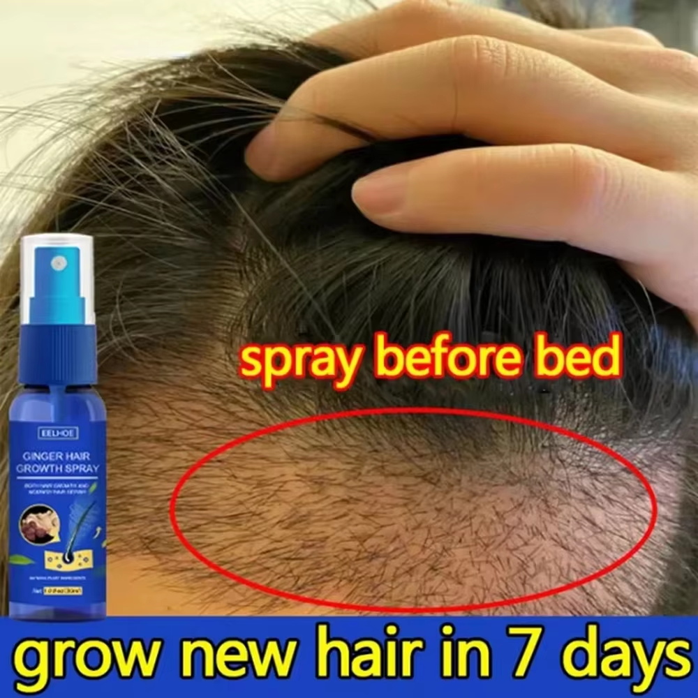 Ginger Hair Growth spray Anti  - Hair Care For Hair Loss 리뷰 및 가격