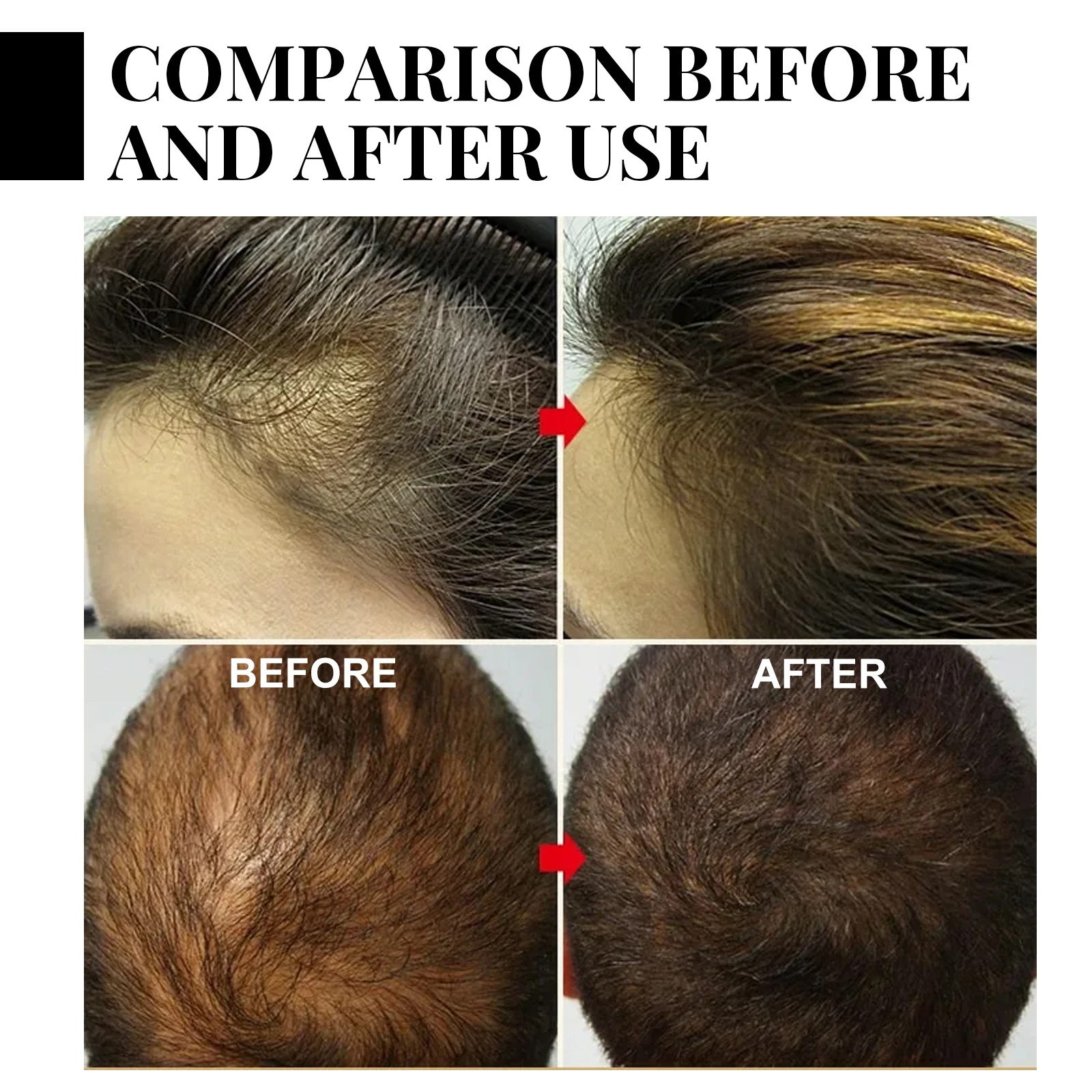 Ginger Hair Growth spray Anti  - Hair Care For Hair Loss 리뷰 및 가격