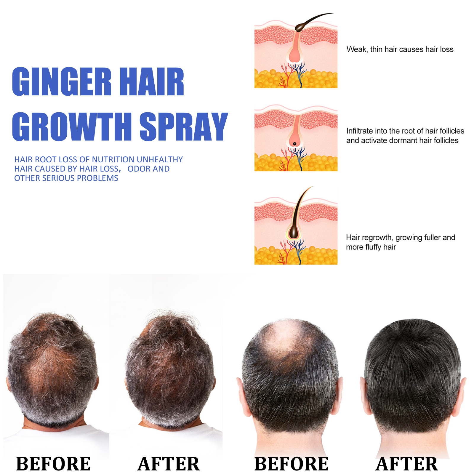 Ginger Hair Growth spray Anti  - Hair Care For Hair Loss 리뷰 및 가격