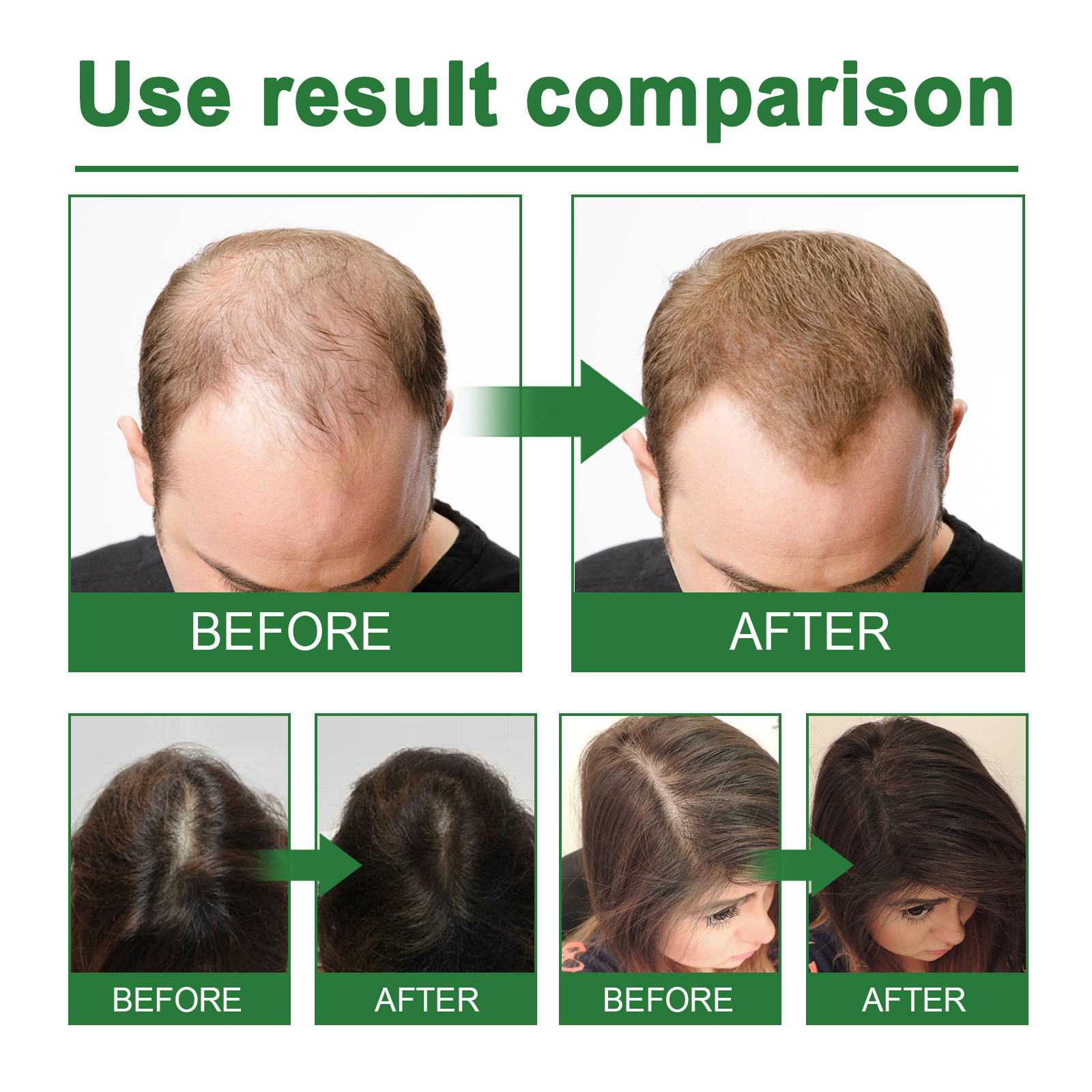 Rosemary Spray for Hair Nouris - Hair Care For Hair Loss 리뷰 및 가격