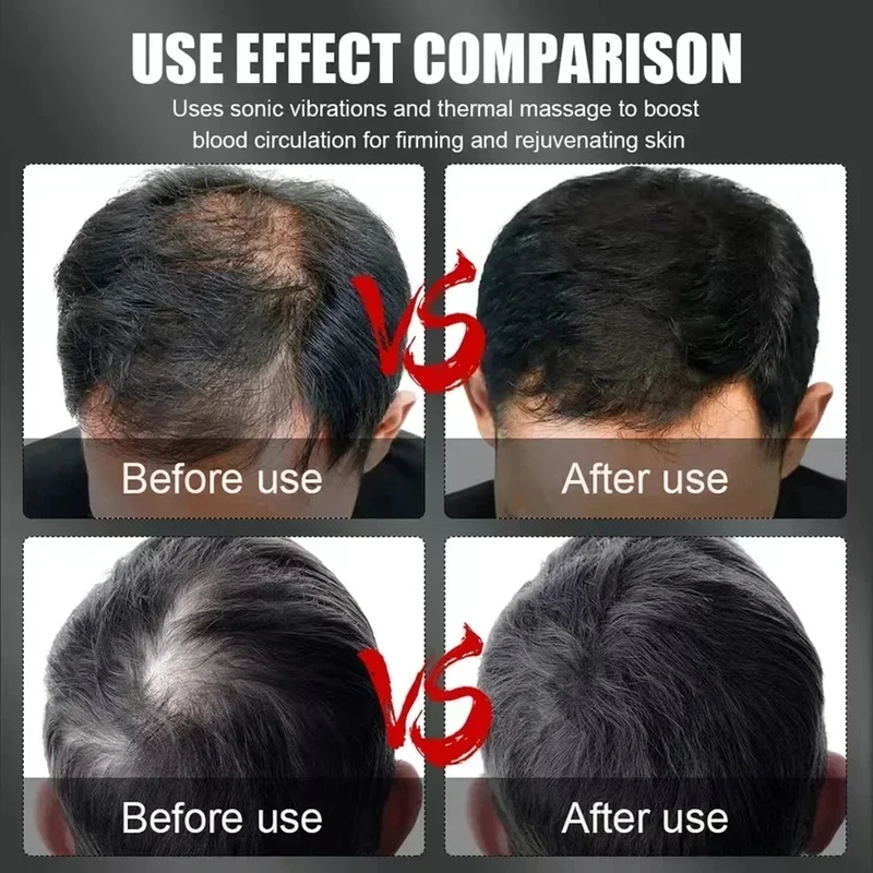 660nm 850nm Red Light Infrared - Hair Care For Hair Loss 리뷰 및 가격